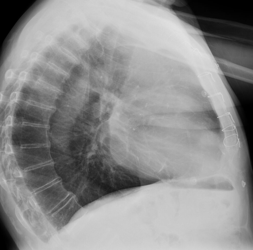 Devices in Radiology | Heart